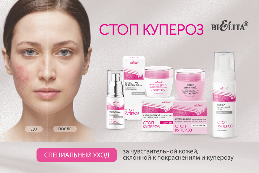 Стоп купероз